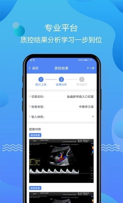 超声智库  v1.2.0图1