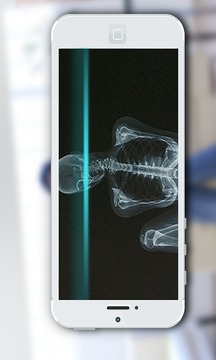 手机X光扫描仪  v图1