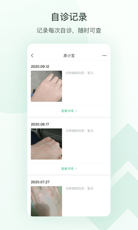 皮小宝  v1.0图2